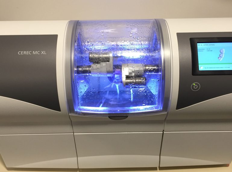 cerec usineuse 3D