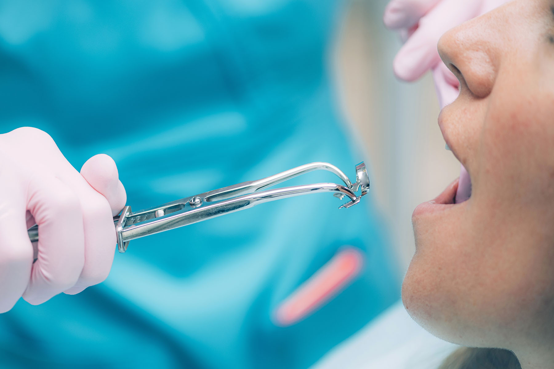 endodontie salon de provence